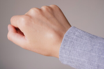 Female right back hand with ganglion cyst on the dorsum,  fluid-filled bump associated with a joint or tendon sheath, close-up view, selected focus.