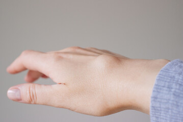 Female right back hand with ganglion cyst on the dorsum,  fluid-filled bump associated with a joint or tendon sheath, close-up view, selected focus.