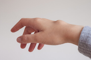 Female right back hand with ganglion cyst on the dorsum,  fluid-filled bump associated with a joint or tendon sheath, close-up view, selected focus.