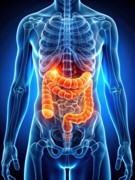 Inflammatory bowel disease in small intestine