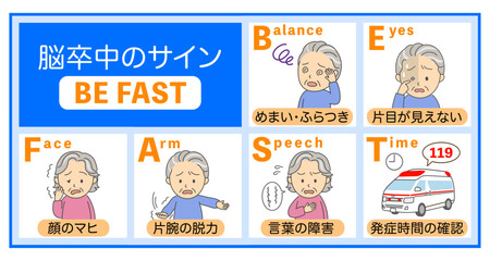 脳卒中の症状BEFASTの説明イラスト青
