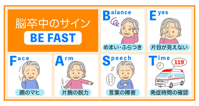 脳卒中の症状BEFASTの説明イラスト橙