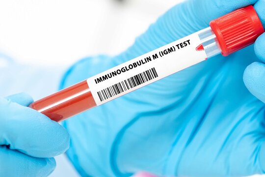 Immunoglobulin M (IgM) Test