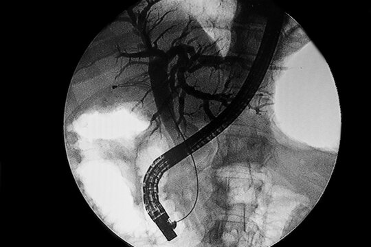 Medical themes: Endoscopic retrograde cholangiopancreatography (ERCP)