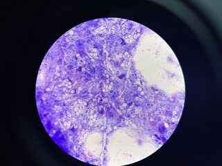 Budding is a form of asexual reproduction, where the new cell develops as an outgrowth from the parent cell.