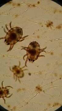Microscopic Mites Under Microscope.