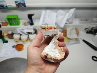 metal-ceramic artificial dentures in the hands
