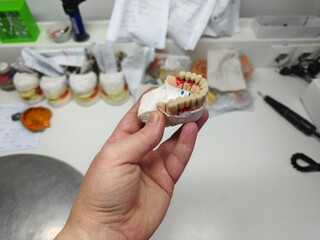 metal-ceramic artificial dentures in the hands