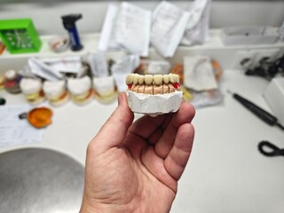 metal-ceramic artificial dentures in the hands