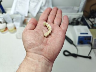 metal-ceramic artificial dentures in the hands