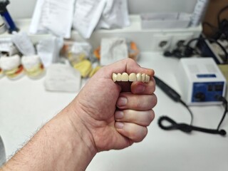 metal-ceramic artificial dentures in the hands