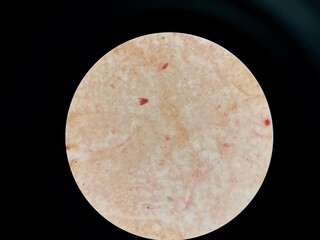 Gram negative bacilli with bipolar stain.