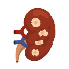 vector illustration of sick kidney theme, damaged kidney with white background