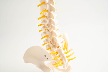 Naklejka premium Spinal nerve and bone, Lumbar spine displaced herniated disc fragment, Model for treatment medical in the orthopedic department.