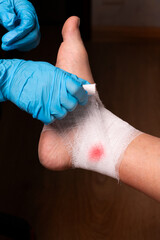 A nurse applies a gauze bandage to the leg of a man with a cut leg injury. High resolution.