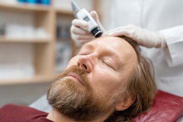 Fototapeta premium A middle-aged man with a beard is undergoing a scalp examination with a handheld dermatoscope by a professional wearing white gloves in a clinical setting