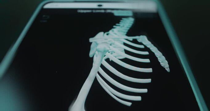Bones of female upper limb right side