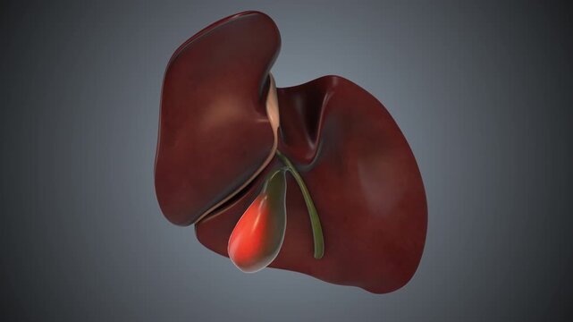 Cholecystectomy Gallbladder Removal Medical Animation
