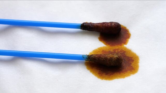 Iodine at the cotton buds. 