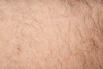 Wet human skin with water drops closeup. Sweat healthy body, macro shower drops on woman skin