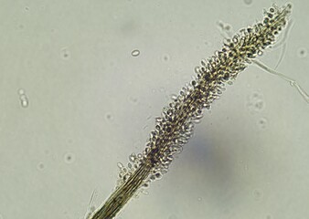 soil microorganisms under a microscope including amoeba, flagellates, nematodes, fungi, bacteria