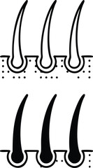 Hair Icons. Black and White Vector Illustration. Hair Bulbs, Human Body Part. Concept Anatomy
