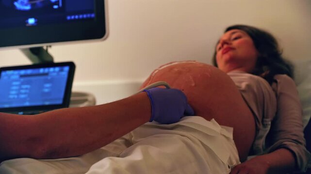 Pregnant woman undergoing an ultrasonography at a doctor's office
