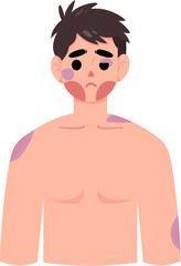 Fototapeta premium Bruise