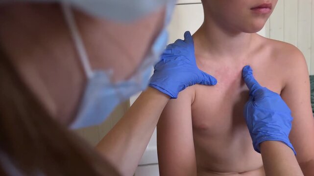 The physician is examining the boy for symptoms of smallpox-like illness.