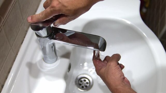 Hand with burn blister treated under cold running water from faucet. First aid, skin injury, pain relief, and healthcare concept.