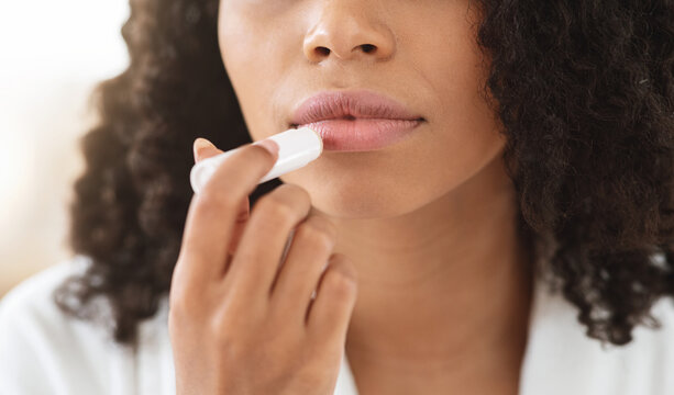 Chapped Lips Remedies. Black Woman Applying Chapstick Moisturizing Lip Balm, Cropped Image, Closeup