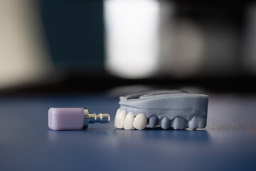 Close-up of a ceramic CAD/CAM crown block next to a partial dental model with white prosthetic teeth. Concept of dental restoration, prosthetics, and digital dentistry.

