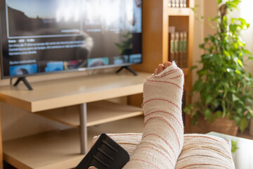 Person with a broken leg wrapped in a plaster cast rests on a sofa at home, elevating their injured limb while watching streaming television for entertainment and recovery
