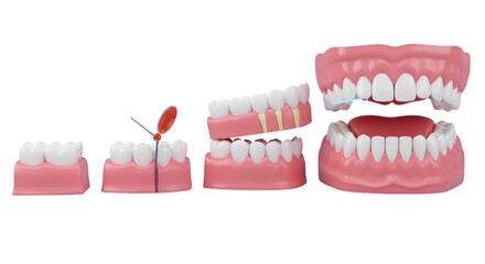Dental Model Anatomy Series Showing Teeth And Gums On Transparent Background