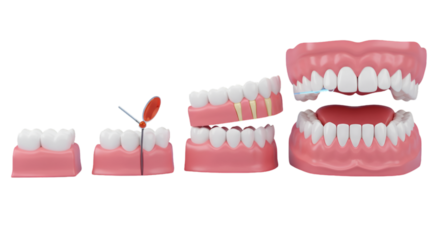 Dental Model Anatomy Series Showing Teeth And Gums On Transparent Background