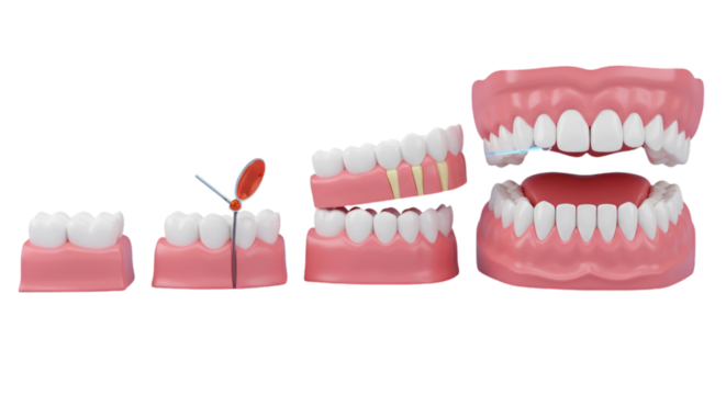 Dental Model Anatomy Series Showing Teeth And Gums On Transparent Background