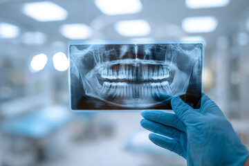 Doctor holds X-ray of jaw, teeth in examination room. Suitable for dental marketing, medical article, presentation.