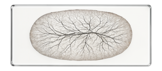 Thin section of nerve tissue on a slide, with silver staining to enhance axon visualization