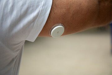 Man Wearing Freestyle Libre Sensor on Arm