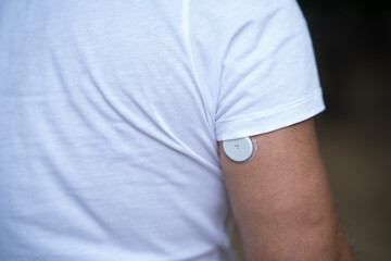 Man Wearing Freestyle Libre Sensor on Arm