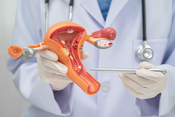Uterus, doctor holding human anatomy model for study diagnosis and treatment in hospital.