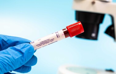 Identifies antibodies to LCMV, indicating infection.