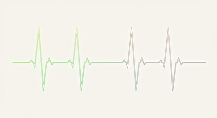 A graphic representation of a heartbeat on a plain background