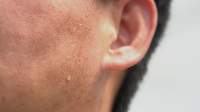 Sweat dripped from his forehead