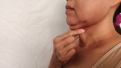 portrait the fingers holding the flabbiness adipose sagging skin under the neck, neck wattle and cellulite, Flabby skin and loose on the throat of the woman, health care and beauty concept.