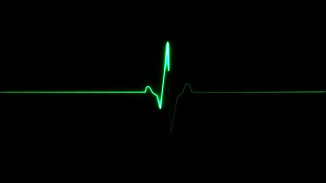 Cardiac arrest on the medical monitor, heart stops beating. Heart beating then hearts deadline on black background. Seamlessly loop footage.