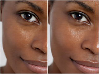 Realistic before and after comparison of African woman's skin improvement, left side shows dull uneven tone, right side reveals brightened clear complexion after sheet mask treatment, brown skin, high