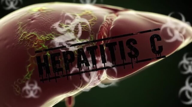 Patchy Scarred Liver Pulsing with Toxic Tones and Biohazard Symbols &mdash; HEPATITIS C Text in Grungy Ink Bleed Font

