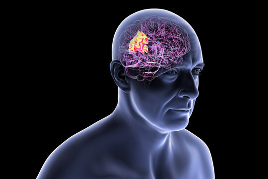 Human brain with highlighted precuneus gyrus, 3D illustration