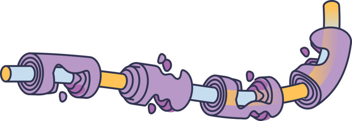 An illustration of a damaged myelin sheath around a nerve axon. The purple sheath is breaking apart, symbolizing demyelination and nerve signal disruption in neurological disorders.